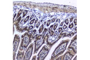 IHC analysis of splicing factor 1 using anti-splicing factor 1 antibody . (Splicing Factor 1 antibody  (AA 160-266))