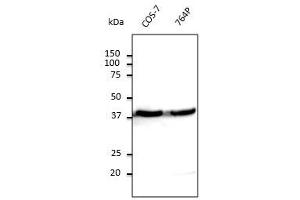 Anti-beta-Actin Ab at 1/500 dilution, lysates at 100 µg per Iane, Rabbit polyclonal to goat lgG (HRP) at 1/10,000 dilution, (beta Actin antibody  (N-Term))