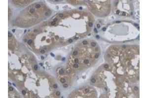 DAB staining on IHC-P; Samples: Human Kidney Tissue (Kallikrein 9 antibody  (AA 1-250))