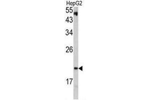 Western blot analysis of VHL antibody (C-term) in HepG2 cell line lysates (35ug/lane). (VHL antibody  (C-Term))