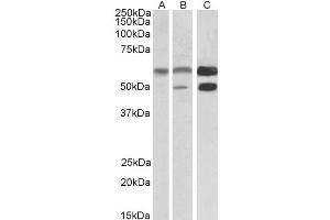 Western Blotting (WB) image for anti-Calcium/calmodulin-Dependent Protein Kinase II alpha (CAMK2A) antibody (ABIN5895999) (CAMK2A antibody)
