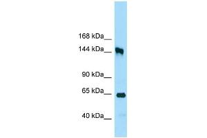 WB Suggested Anti-RRP12 Antibody Titration: 1. (RRP12 antibody  (C-Term))