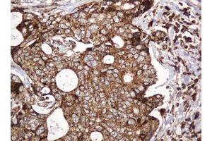 Image no. 10 for anti-B and T Lymphocyte Associated (BTLA) antibody (ABIN1496983)