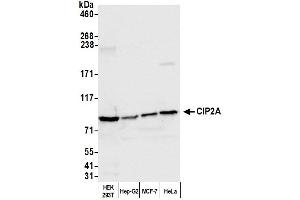 Western Blotting (WB) image for anti-KIAA1524 (KIAA1524) (AA 853-903) antibody (ABIN7453880)