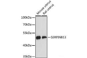Western blot analysis of extracts of various cell lines using SERPINB13 Polyclonal Antibody at dilution of 1:3000. (SERPINB13 antibody)