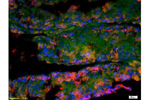 Formalin-fixed and paraffin-embedded rat testis labeled with Anti-IFNAR2/IFNABR Polyclonal Antibody, Unconjugated (ABIN721825) 1:200, overnight at 4°C, The secondary antibody was Goat Anti-Rabbit IgG, Cy3 conjugated used at 1:200 dilution for 40 minutes at 37°C. (IFNAR2 antibody  (AA 165-260))