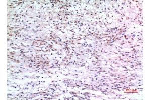 Immunohistochemistry (IHC) analysis of paraffin-embedded Human Brain, antibody was diluted at 1:100. (ZKSCAN4 antibody  (Internal Region))