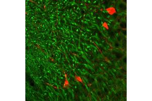 Indirect immunohystochemistry of a rat hippocampus section with anti-MAP 2 (dilution 1 : 500; green) and parvalbumin guinea pig antiserum (cat. (MAP2 antibody  (AA 2-309))