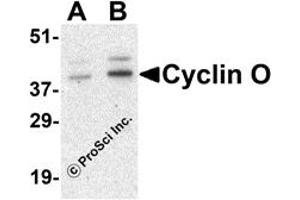 Western Blotting (WB) image for anti-Cyclin O (CCNO) (Middle Region) antibody (ABIN1031155)