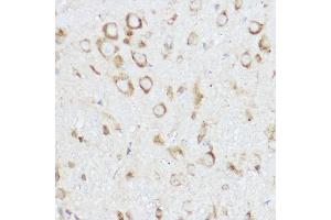 Immunohistochemistry of paraffin-embedded mouse spinal cord using NEURL1B Rabbit pAb (ABIN7268857) at dilution of 1:100 (40x lens). (NEURL1B antibody)