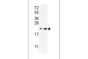ABHEB Antibody (C-term) (ABIN653654 and ABIN2842995) western blot analysis in ,T47D cell line lysates (35 μg/lane).