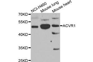 Western blot analysis of extracts of various cell lines, using ACVR1 antibody (ABIN5975601) at 1/1000 dilution. (ACVR1 antibody)