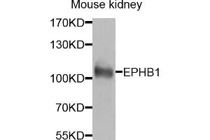 Western blot analysis of extracts of mouse kidney, using EPHB1 antibody (ABIN5974587) at 1/1000 dilution. (EPH Receptor B1 antibody)
