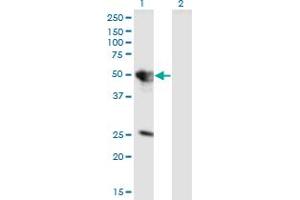 Western Blot analysis of TUFT1 expression in transfected 293T cell line by TUFT1 monoclonal antibody (M01), clone 2C10. (TUFT1 antibody  (AA 241-350))