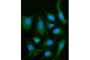 anti-Phospholipase D family member 3 (PLD3) (AA 1-490) antibody