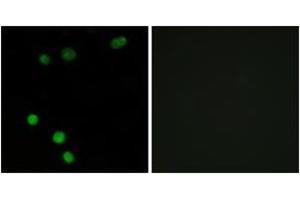 Immunofluorescence analysis of MCF7 cells, using TP53INP2 Antibody. (TP53INP2 antibody  (AA 1-50))