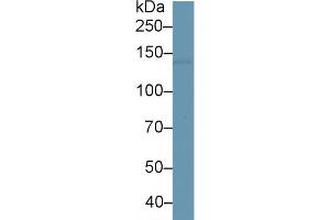 Rabbit Capture antibody from the kit in WB with Positive Control: Human brain tissue. (L1CAM ELISA Kit)