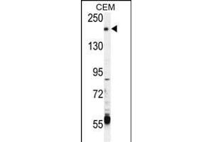 CHAK2 Antibody  (ABIN392616 and ABIN2842133) western blot analysis in CEM cell line lysates (35 μg/lane).
