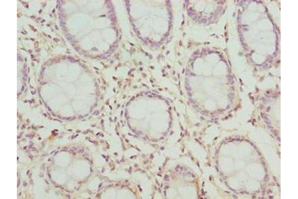 CLYBL antibody  (AA 23-340)