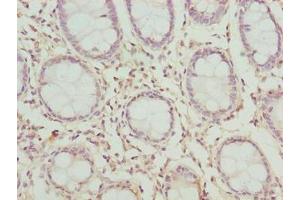 Immunohistochemistry of paraffin-embedded human colon tissue using ABIN7147805 at dilution of 1:100