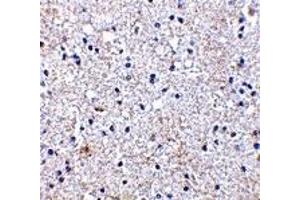 Immunohistochemistry (IHC) image for anti-SCO1 Cytochrome C Oxidase Assembly Protein (SCO1) (Middle Region) antibody (ABIN1031080) (SCO1 antibody  (Middle Region))