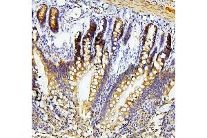 IHC analysis of RET using anti-RET antibody (ABIN6719502). (Ret Proto-Oncogene antibody  (AA 29-304))