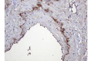 Image no. 1 for anti-Parvin, beta (PARVB) antibody (ABIN1496912) (Parvin, beta antibody)