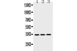 Western blot analysis of Emerin expression in rat skeletal muscle extract ( Lane 1), mouse cardiac muscle extract ( Lane 2) and HELA whole cell lysates ( Lane 3).
