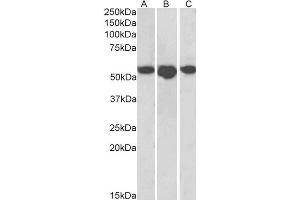 ABIN4902615 (1µg/ml) staining of Human Breast (A), Placenta (B) and Spleen (C) lysates (35µg protein in RIPA buffer). (SLC29A1 antibody)