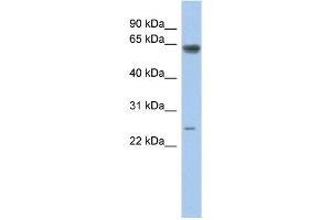 WB Suggested Anti-TAF5L Antibody Titration:  0. (TAF5L antibody  (Middle Region))