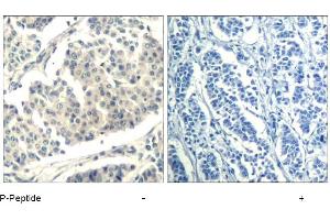 Image no. 1 for anti-Abelson Murine Leukemia Viral Oncogene Homolog 1/2 (ABL1/ABL2) (pTyr393), (pTyr439) antibody (ABIN319285) (ABL1/2 antibody  (pTyr393, pTyr439))