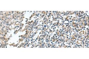 Immunohistochemistry of paraffin-embedded Human tonsil tissue using PAPSS2 Polyclonal Antibody at dilution of 1:95(x200) (PAPSS2 antibody)