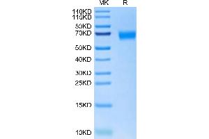 Cynomolgus NOGOR on Tris-Bis PAGE under reduced condition. (Reticulon 4 Protein (RTN4) (AA 27-447) (His tag))