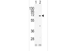 Western blot analysis of TXK (arrow) using rabbit polyclonal hTXK-E37 (ABIN392114 and ABIN2841863). (TXK antibody  (N-Term))