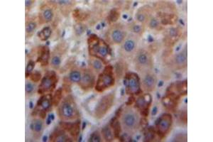 Used in DAB staining on fromalin fixed paraffin-embedded Liver tissue (COL18 antibody  (AA 1591-1774))