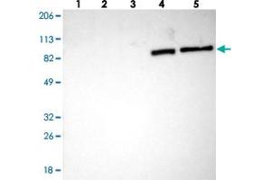 Western blot analysis of Lane 1: Human cell line RT-4, Lane 2: Human cell line U-251MG sp, Lane 3: Human cell line A-431, Lane 4: Human liver tissue, Lane 5: Human tonsil tissue with TF polyclonal antibody . (Transferrin antibody)