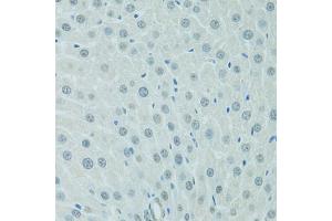 Immunohistochemistry of paraffin-embedded rat liver using CEBPA antibody (ABIN4903245) at dilution of 1:100 (40x lens). (CEBPA antibody)