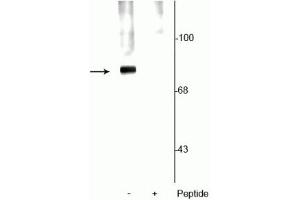 Western blot of rat cortical lysate showing specific labeling of the ~78 kDa synapsin protein phosphorylated at Ser62,67 in the first lane (-). (SYN1 antibody  (pSer62, pSer67))