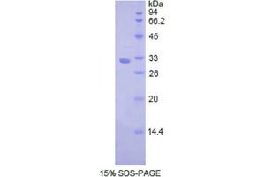 SDS-PAGE analysis of Human Cathepsin V Protein.