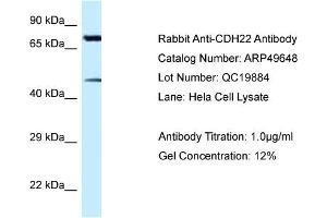 Western Blotting (WB) image for anti-Cadherin-Like 22 (CDH22) (N-Term) antibody (ABIN2783833)
