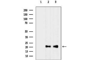 anti-Mitochondrial Ribosomal Protein L12 (MRPL12) (Internal Region) antibody