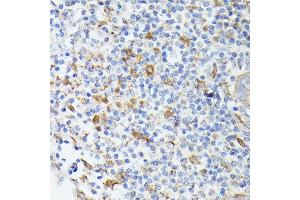 Immunohistochemistry of paraffin-embedded human appendix using TI antibody (ABIN6133213, ABIN6149144, ABIN6149145 and ABIN6221696) at dilution of 1:100 (40x lens). (TIAL1 antibody  (AA 266-375))