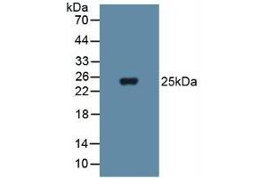 Detection of SOD3 in Human Blood Cells using Polyclonal Antibody to Superoxide Dismutase 3, Extracellular (SOD3) (SOD3 antibody  (AA 19-240))
