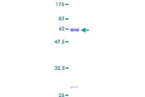 PDHB Protein (AA 1-359) (GST tag)