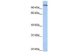 FES antibody used at 1 ug/ml to detect target protein. (FES antibody  (N-Term))