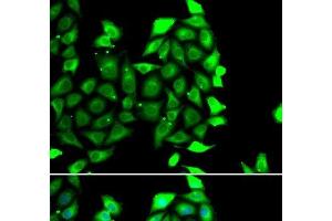 Immunofluorescence analysis of MCF-7 cells using IKZF3 Polyclonal Antibody (IKZF3 antibody)