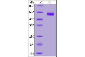 Fed Human ROR1, His Tag on  under reducing (R) condition. (ROR1 Protein (AA 30-403) (His tag,FITC))