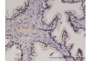 Immunoperoxidase of monoclonal antibody to RECQL4 on formalin-fixed paraffin-embedded human prostate. (RECQL4 antibody  (AA 1-652))