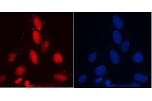 IF analysis of RENT1/hUPF1 using anti-RENT1/hUPF1 antibody (ABIN7602979). (RENT1/UPF1 antibody  (Middle Region))