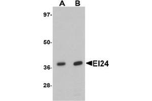 Western blot analysis of EI24 in rat liver tissue lysate with EI24 antibody at (A) 1 and (B) 2 ug/mL.